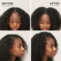The Ultimate Healthy Scalp Duo Bundle