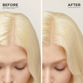 The Ultimate Healthy Scalp Duo Bundle