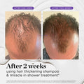 The Ultimate Healthy Scalp Duo Bundle